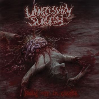 Unnecessary Surgery - Hauled Off in Chunks (2022)