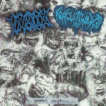 Vomito / Traqueomalacia - Traqueovomitative Grinders: Files of Grotesque Pathologies... (2022)