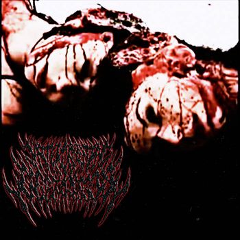Intercranial Laceration - Intercranial Laceration (2022)