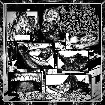 Bodily Stew - Forensic Pathology (2022)