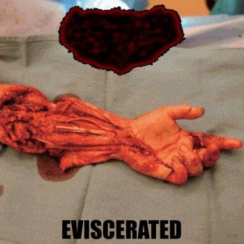 Erythromelalgia - Eviscerated (2022)