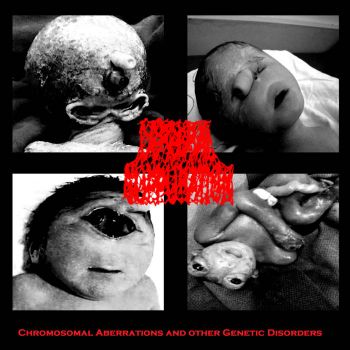 Cerebral Suppuration - Chromosomal Aberrations and other Genetic Disorders (2022)