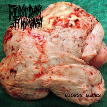 First Days of Humanity - Biopsy Blues (2022)