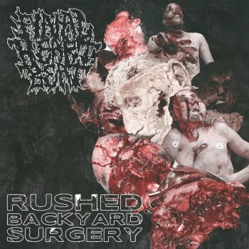 Final Heartbeat - Rushed Backyard Surgery (2022)