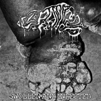 Elephantiasis - Swollen and Infected (2023)