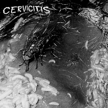 Cervicitis - Cervicitis (2022)