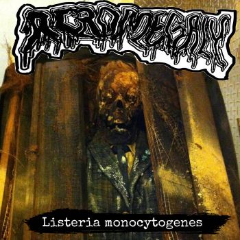 Acromegaly - Listeria Monocytogenes (2023)