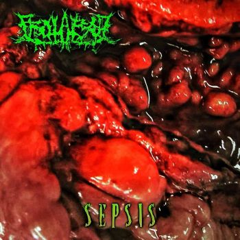 Prolapsed - Sepsis (2023)
