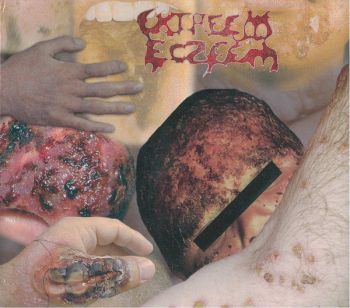 Extreem Eczeem - Magnus Contaminus (2004)