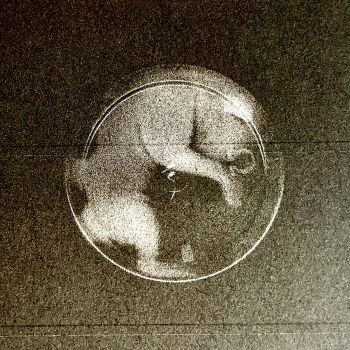 Fetal Speedball - Fermented Mutation Consumation (2023)