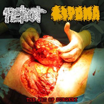 Petiot / Lipoma - The Art of Surgery (2023)