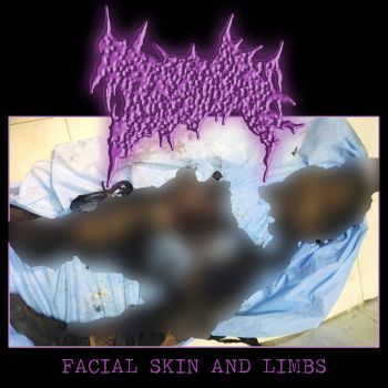 Tumorous Deformity - Facial Skin and Limbs (2023)