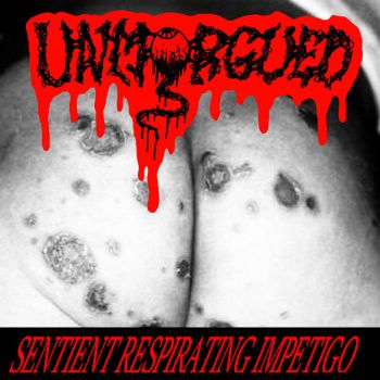 Unmorgued - Sentient Respirating Impetigo (2023)