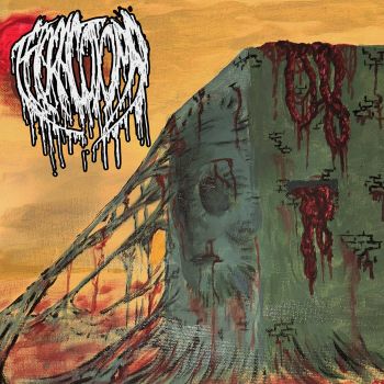 Thoracotomy - Cerebrospinal Implant (2023)