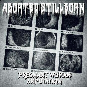 Aborted Stillborn - Pregnant Woman Amputation (2023)