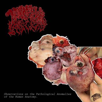 Terminal Secretions - Observations on the Pathological Anomalies of the Human Anatomy (2023)