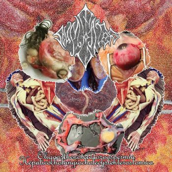 Scumeater - Oligoasthenoteratozoospermia Hepaticocholangiocholecystenterostomica (2023)