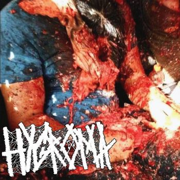 Hygroma - Demo 2023 (2023)