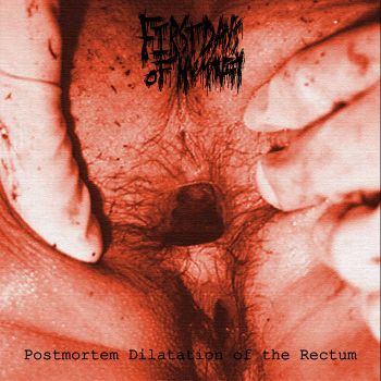 First Days of Humanity - Postmortem Dilatation of the Rectum (2023)