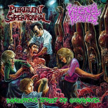 Purulent Spermcanal / Vaginal Herpes - Dangerous Street of Guayaquil (2023)