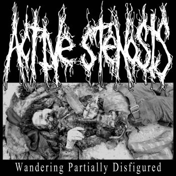 Active Stenosis - Wandering Partially Disfigured (2023)