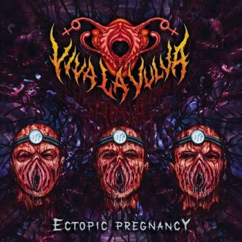 Viva la Vulva - Ectopic Pregnancy (2023)