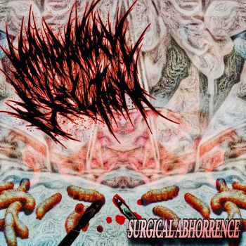 Mandatory Execution - Surgical Abhorrence (2023)