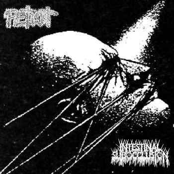 Intestinal Subocclusion / Petiot - Split (2024)