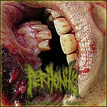 Peritonitis - The Forensick Clock (2024)