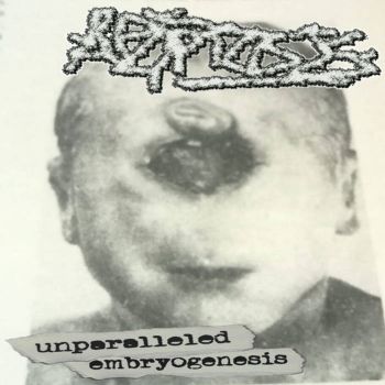 Apoptosis - Unparalleled Embryogenesis (2024)