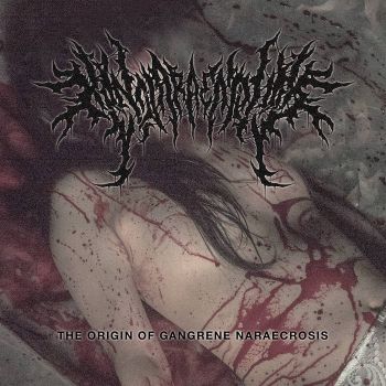 Hannaraectomy - The Origin of Gangrene Naraecrosis (2024)