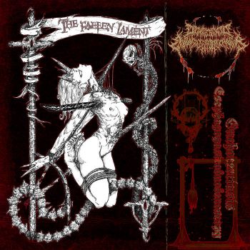 Onchocerciasis Esophagogastroduodenoscopy - The Fallen Lament (2024)