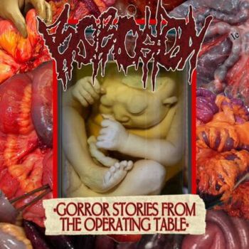 Korosion - Gorror Stories from the Operating Theatre (2024)