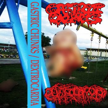 Gastric Chunks / Dextrocardia - Split (2024)