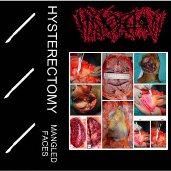 Hysterectomy - Mangled Faces (2024)