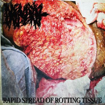 Neural Indent - Rapid Spread of Rotting Tissue (2024)