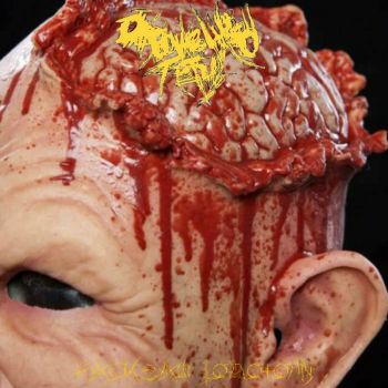 Disemboweled Fetus - Hacksaw Lobotomy (2024)