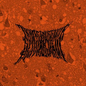 Transmissible Spongiform Encephalopathy - Transmissible Spongiform Encephalopathy (2024)