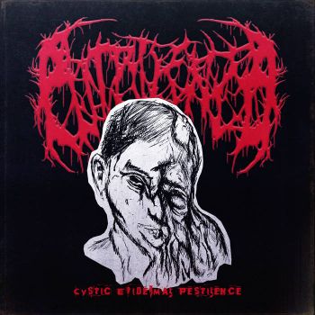 Putrilence - Cystic Epidermal Pestilence (2025)