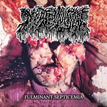 Meat Emulsion - Fulminant Septicemia (2024)