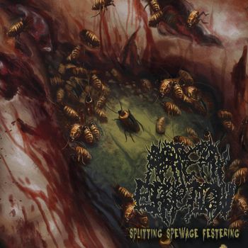 Artery Eruption - Splitting Spewage Festering (2025)