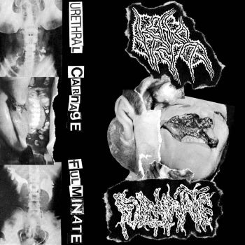 Urethral Carnage / Fulminate - Split (2025)