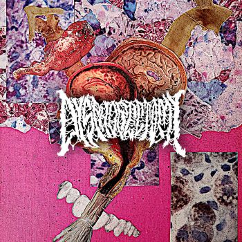 Dysphorectomy - Remnants (2025)