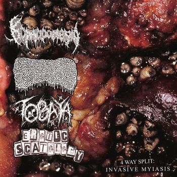 Komodonesia / Lymphoedema / Tobaya / Erotic Scatology - Invasive Myiasis (2025)