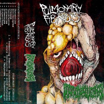 Pulmonary Fibrosis / Apopathodiaphulatophobia - Split (2025)