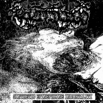 Revitiligo - Synthetic Epinephrine Inmortality (2025)
