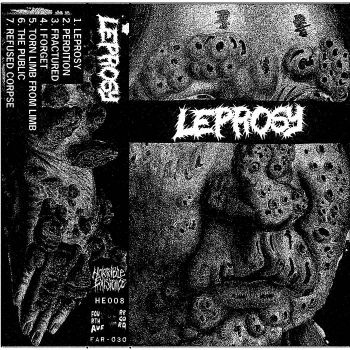 Leprosy - Leprosy (2025)