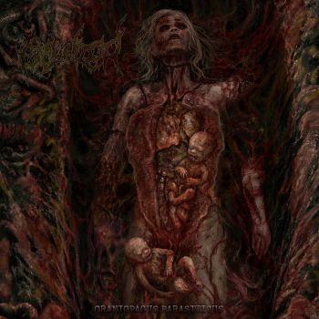 Faecalized - Craniopagus Parasiticus (2025)