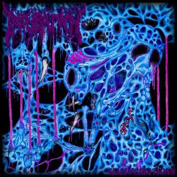 Intubation - Hallucinations (2025)