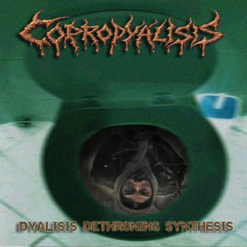 Coprodyalisis - Dyalisis Dethroning Synthesis (2025)